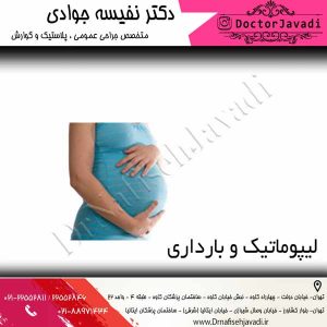لیپوماتیک و بارداری 