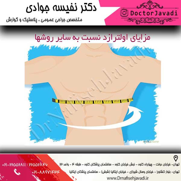 تکنیک اولترازد
