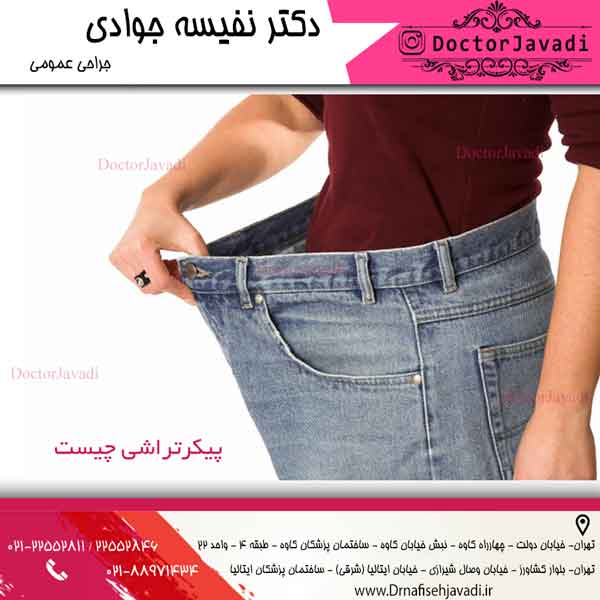 پیکرتراشی چیست